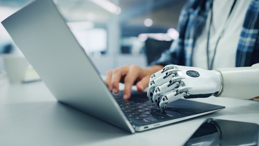 A person typing on a laptop with one robotic arm.